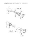 INCISIONLESS GASTRIC BYPASS METHOD & DEVICES diagram and image