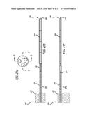 INCISIONLESS GASTRIC BYPASS METHOD & DEVICES diagram and image