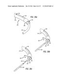 INCISIONLESS GASTRIC BYPASS METHOD & DEVICES diagram and image