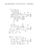 SURGICAL IMPLANT AND METHOD AND INSTRUMENT FOR INSTALLING THE SAME diagram and image