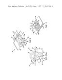 SURGICAL IMPLANT AND METHOD AND INSTRUMENT FOR INSTALLING THE SAME diagram and image