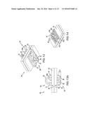 SURGICAL IMPLANT AND METHOD AND INSTRUMENT FOR INSTALLING THE SAME diagram and image