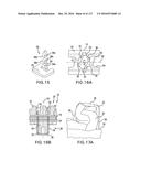 SURGICAL IMPLANT AND METHOD AND INSTRUMENT FOR INSTALLING THE SAME diagram and image