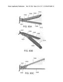 SURGICAL IMPLANT AND METHOD AND INSTRUMENT FOR INSTALLING THE SAME diagram and image