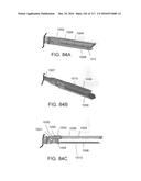 SURGICAL IMPLANT AND METHOD AND INSTRUMENT FOR INSTALLING THE SAME diagram and image