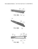 SURGICAL IMPLANT AND METHOD AND INSTRUMENT FOR INSTALLING THE SAME diagram and image