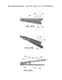 SURGICAL IMPLANT AND METHOD AND INSTRUMENT FOR INSTALLING THE SAME diagram and image