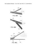 SURGICAL IMPLANT AND METHOD AND INSTRUMENT FOR INSTALLING THE SAME diagram and image