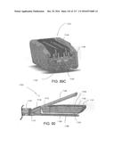 SURGICAL IMPLANT AND METHOD AND INSTRUMENT FOR INSTALLING THE SAME diagram and image