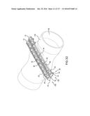 SURGICAL IMPLANT AND METHOD AND INSTRUMENT FOR INSTALLING THE SAME diagram and image