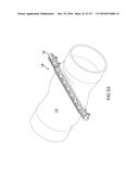 SURGICAL IMPLANT AND METHOD AND INSTRUMENT FOR INSTALLING THE SAME diagram and image