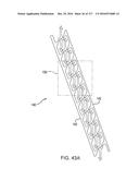 SURGICAL IMPLANT AND METHOD AND INSTRUMENT FOR INSTALLING THE SAME diagram and image