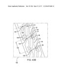 SURGICAL IMPLANT AND METHOD AND INSTRUMENT FOR INSTALLING THE SAME diagram and image