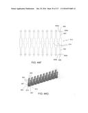 SURGICAL IMPLANT AND METHOD AND INSTRUMENT FOR INSTALLING THE SAME diagram and image