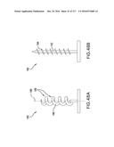 SURGICAL IMPLANT AND METHOD AND INSTRUMENT FOR INSTALLING THE SAME diagram and image