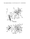 SURGICAL IMPLANT AND METHOD AND INSTRUMENT FOR INSTALLING THE SAME diagram and image