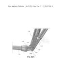 SURGICAL IMPLANT AND METHOD AND INSTRUMENT FOR INSTALLING THE SAME diagram and image