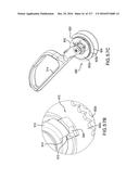 SURGICAL IMPLANT AND METHOD AND INSTRUMENT FOR INSTALLING THE SAME diagram and image