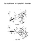 SURGICAL IMPLANT AND METHOD AND INSTRUMENT FOR INSTALLING THE SAME diagram and image