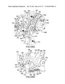 SURGICAL IMPLANT AND METHOD AND INSTRUMENT FOR INSTALLING THE SAME diagram and image