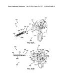 SURGICAL IMPLANT AND METHOD AND INSTRUMENT FOR INSTALLING THE SAME diagram and image