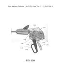 SURGICAL IMPLANT AND METHOD AND INSTRUMENT FOR INSTALLING THE SAME diagram and image