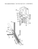 SURGICAL IMPLANT AND METHOD AND INSTRUMENT FOR INSTALLING THE SAME diagram and image