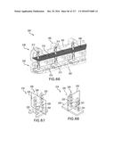 SURGICAL IMPLANT AND METHOD AND INSTRUMENT FOR INSTALLING THE SAME diagram and image