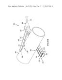 SURGICAL IMPLANT AND METHOD AND INSTRUMENT FOR INSTALLING THE SAME diagram and image