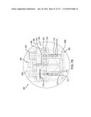 SURGICAL IMPLANT AND METHOD AND INSTRUMENT FOR INSTALLING THE SAME diagram and image