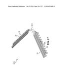 SURGICAL IMPLANT AND METHOD AND INSTRUMENT FOR INSTALLING THE SAME diagram and image