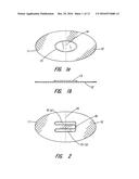 PARTIAL CUFF diagram and image