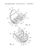 SYSTEM FOR USE IN KNEE SURGERY diagram and image