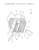 SYSTEM FOR USE IN KNEE SURGERY diagram and image