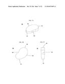 BONE IMPLANTS AND CUTTING APPARATUSES AND METHODS diagram and image