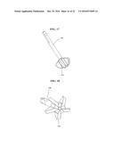 BONE IMPLANTS AND CUTTING APPARATUSES AND METHODS diagram and image