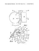 Patient-Specific Humeral Guide Designs diagram and image