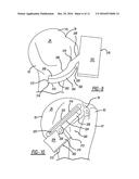 Patient-Specific Humeral Guide Designs diagram and image