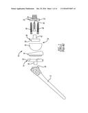 PATIENT-SPECIFIC HUMERAL GUIDE DESIGNS diagram and image