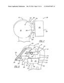 PATIENT-SPECIFIC HUMERAL GUIDE DESIGNS diagram and image