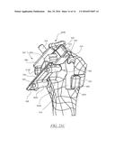 PATIENT-SPECIFIC HUMERAL GUIDE DESIGNS diagram and image