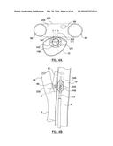 CAROTID BODY ABLATION WITH A TRANSVENOUS ULTRASOUND IMAGING AND ABLATION     CATHETER diagram and image