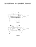 CAROTID BODY ABLATION WITH A TRANSVENOUS ULTRASOUND IMAGING AND ABLATION     CATHETER diagram and image