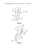 CAROTID BODY ABLATION WITH A TRANSVENOUS ULTRASOUND IMAGING AND ABLATION     CATHETER diagram and image