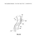 CAROTID BODY ABLATION WITH A TRANSVENOUS ULTRASOUND IMAGING AND ABLATION     CATHETER diagram and image