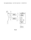 CAROTID BODY ABLATION WITH A TRANSVENOUS ULTRASOUND IMAGING AND ABLATION     CATHETER diagram and image