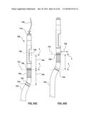 CAROTID BODY ABLATION WITH A TRANSVENOUS ULTRASOUND IMAGING AND ABLATION     CATHETER diagram and image