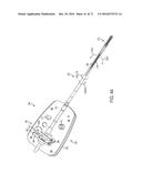 SURGICAL INSTRUMENTS WITH ARTICULATING SHAFTS diagram and image