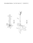 SURGICAL INSTRUMENTS WITH ARTICULATING SHAFTS diagram and image