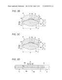 SURGICAL APPARATUS diagram and image